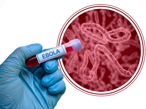  hand wearing a blue nitrile glove holding a blood sample test tube 