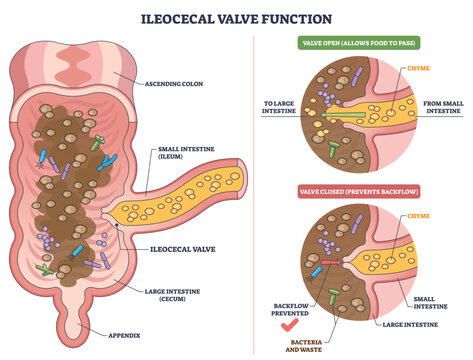 Ileocecal valve function shown with small intestine, large intestine, and valve illustrating one-way flow of chyme and prevention of backflow, transparent background