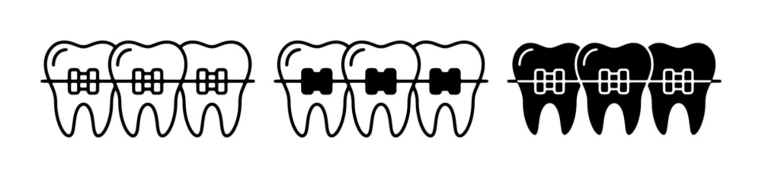 Dental Braces Icons, Orthodontic Treatment Vector Set, Teeth Alignment Symbols