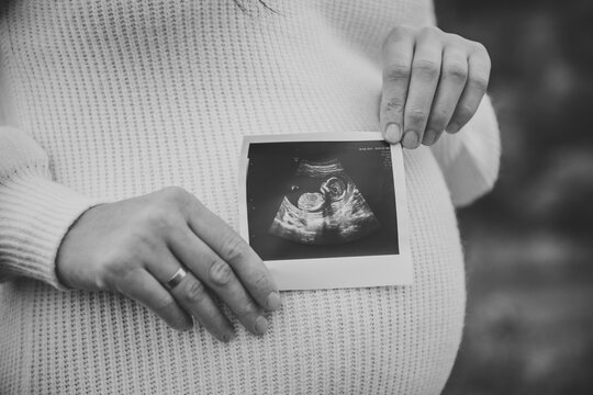 Black and white photo of pregnant woman holding an ultrasound scan picture on her belly. Expecting mother showing baby sonogram photo outdoors in autumn.