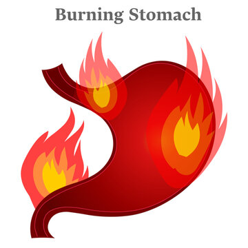 Burning stomach, gastric  pain, fire flaming. Acid reflux, gastro diseases, digestive gastrointestinal cancer.. Vector illustration	