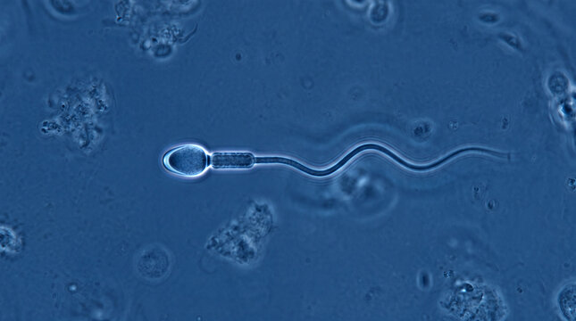 Close-up scientific visualization of sperm cells under microscope, blue medical background, fertility treatment research, IVF procedure concept, reproductive biology, male fertility testing and labora