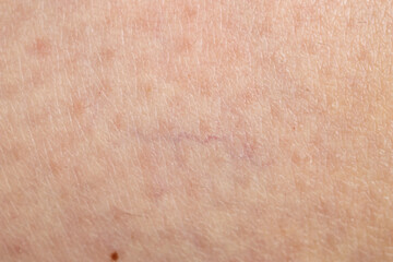 Fototapeta premium Texture of normal skin as background, closeup