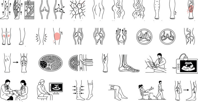 Varicose veins medical line icons set for leg health designVaricose veins medical line icons set for leg health design