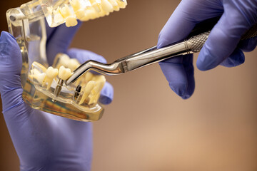 Dental spoon held by dentist over transparent jaw typodont for clinical procedure © Anton