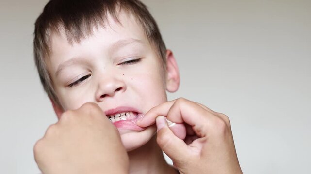 Mother cleans boy teeth with dental floss in slow motion. Close up shows gentle oral hygiene routine and healthy family dental care.