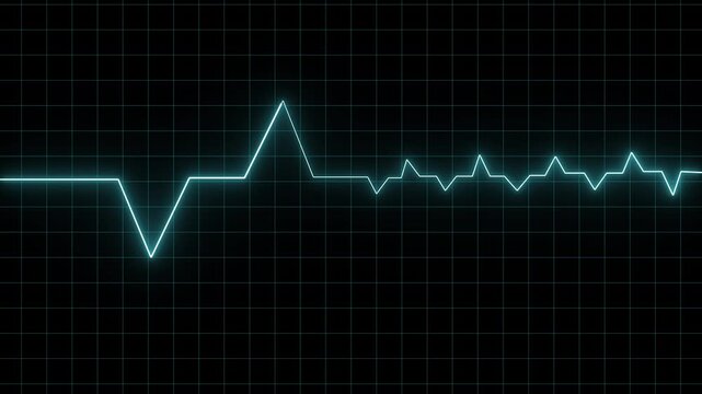 Heartbeat line monitors track patient cardiac performance over a dark grid net. Medical software demonstration clips benefit from this high contrast index. Pulses stream.