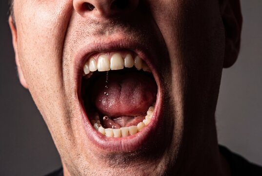 Extreme close-up of a man's open mouth with saliva dripping, showing teeth and tongue in detail.