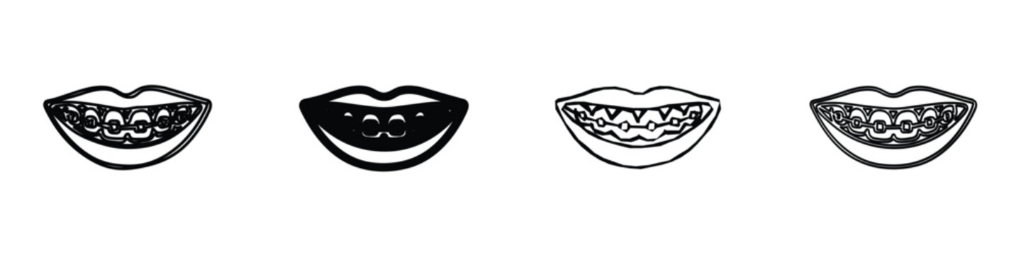 Four distinct line art illustrations depict open mouths with varying dental brace designs and teeth configurations