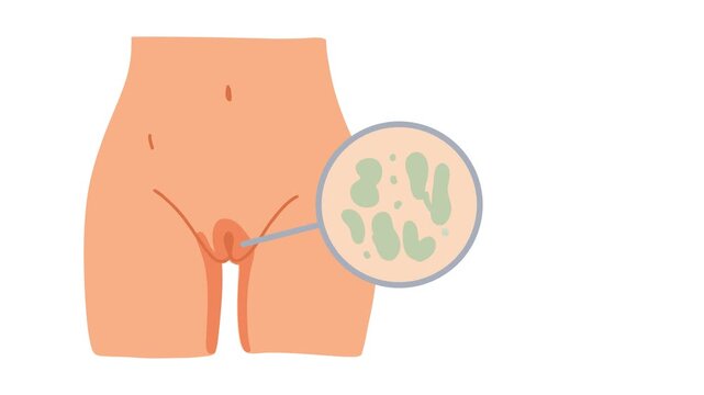 animation gynecological smear test medical laboratory
