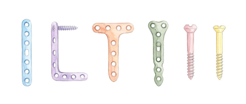 Orthopedic bone plates and screws watercolor illustration set. Medical implants for osteosynthesis, bone fracture repair, trauma surgery hardware. Pastel colored hand drawn artistic medical equipment.