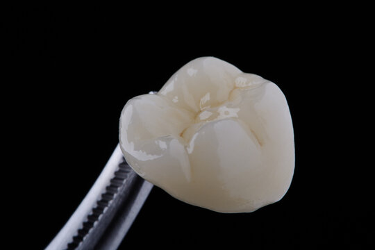 High-quality zirconia dental crown on white background. Dental ceramic crown professional dental lab