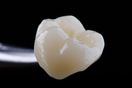 High-quality zirconia dental crown on white background. Dental ceramic crown professional dental lab