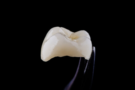 High-quality zirconia dental crown on white background. Dental ceramic crown professional dental lab
