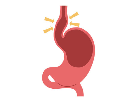Scleroderma Disease in Stomach