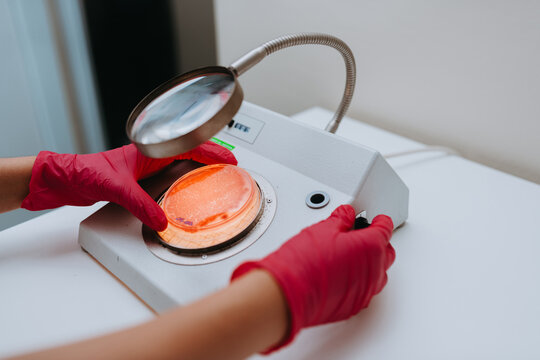 Laboratory Technician Inspecting Bacterial Culture On Petri Dish With Magnifier And Red Gloves