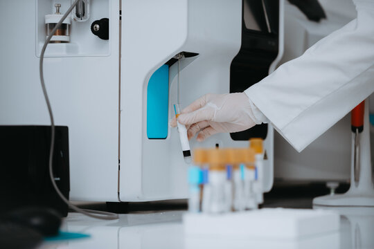 Lab Technician Loading Blood Sample Into Automated Analyzer in Clinical Laboratory