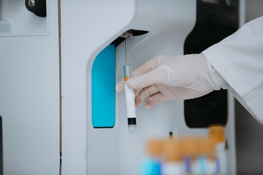 Medical Technician Holding Blood Test Tube Near Automated Laboratory Analyzer Machine For Diagnostic Testing