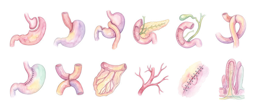 Gastric bypass bariatric surgery diagrams showing stomach anatomy, sleeve gastrectomy, Whipple procedure, intestinal anastomosis, and medical watercolor illustrations isolated on black background.