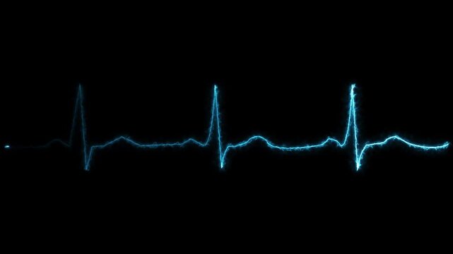 Glowing Electric Blue Heartbeat ECG Pulse Wave Motion Graphic Animation on Black Background , with video animation.