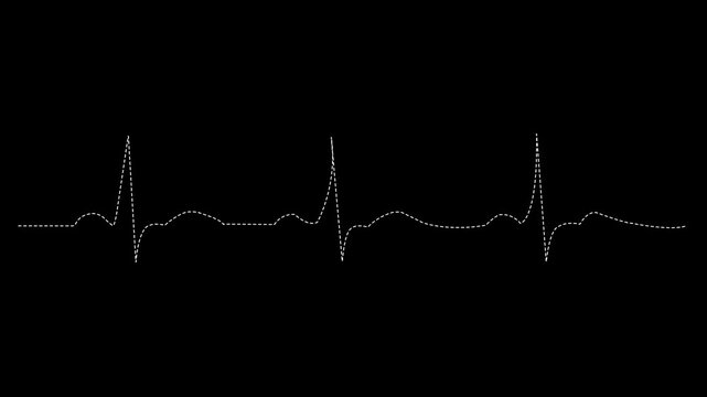 EKG Heartbeat Pulse Line Motion Graphic Cardiology Monitor Heart Rate Signal Animation Black Background