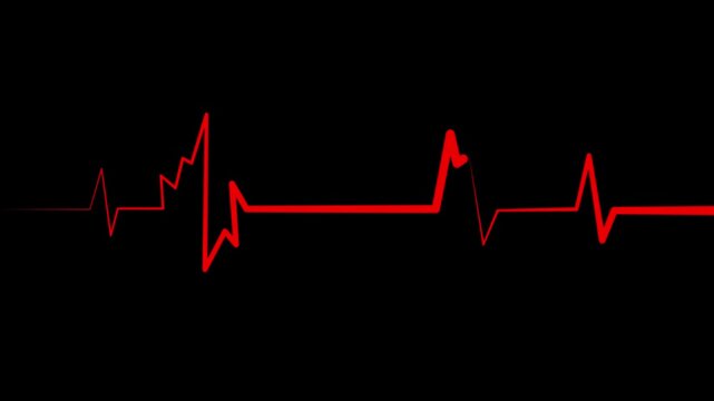A clean white electrocardiogram line traces a heartbeat pattern on a black background,showing cardiogram line style motion graphics in loop ECG medical concept