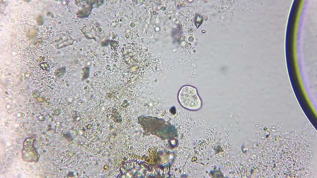 Microscopic view of Colpoda ciliate feeding on bacteria, protozoan swimming in water sample at 400x magnification, brightfield microscopy