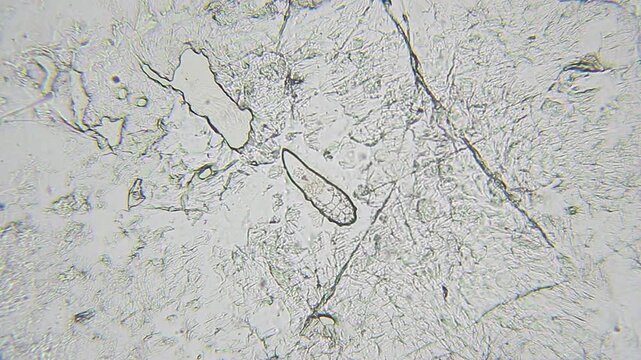 Demodex brevis skin mite crawling among skin cells and sebum, microscopic view at 400x magnification, brightfield microscopy