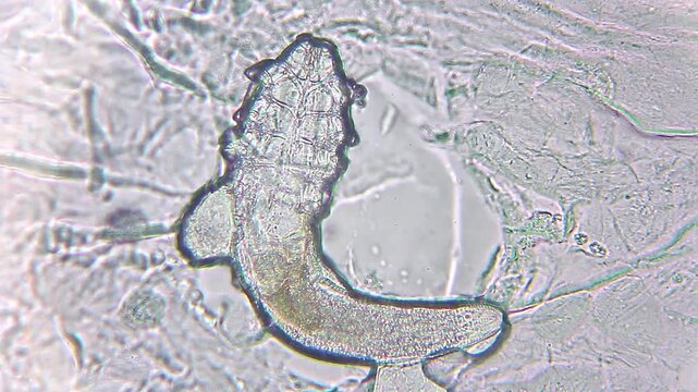 Demodex folliculorum skin mite under microscope showing body structure and moving legs, 400x magnification, brightfield microscopy