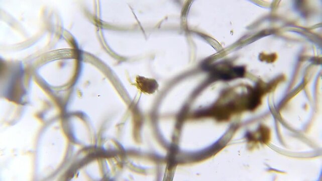 Colony of nematode roundworms moving in a dirty water droplet, microscopic view at 100x magnification, brightfield microscopy