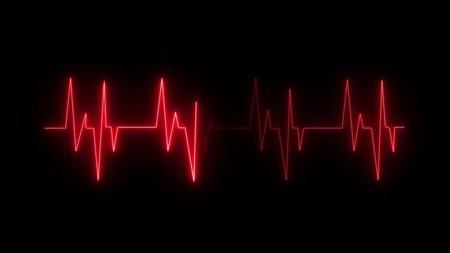 Red ECG heartbeat flatline on transprent background. Represents cardiac arrest, medical emergency 4k