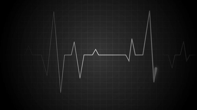 Heartbeat line on a grid pulse pattern for health medicine and emergency monitoring animation