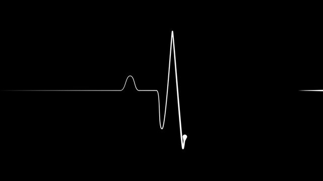 Minimal heartbeat line sharp pulse showing a flat medical monitor trace animation