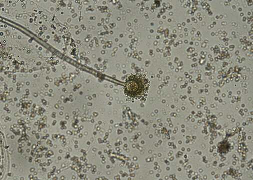 soil microorganisms under a microscope including amoeba, flagellates, nematodes, fungi, bacteria	