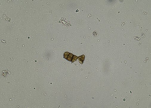 soil microorganisms under a microscope including amoeba, flagellates, nematodes, fungi, bacteria	