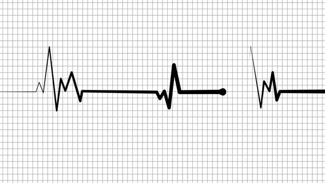 Health heartbeat line medical ekg rhythm pattern health monitor signal and heart activity chart animation