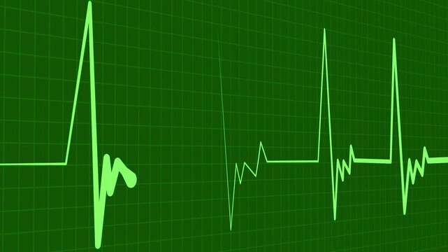 Heart monitor line medical pulse pattern with a flat section and sharp spikes animation