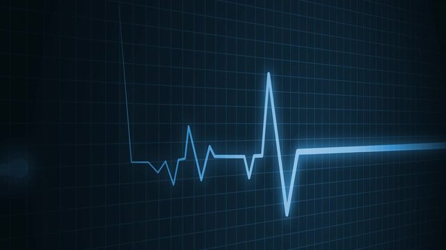 Heart beat line on graph paper showing an ecg pattern and medical signal animation