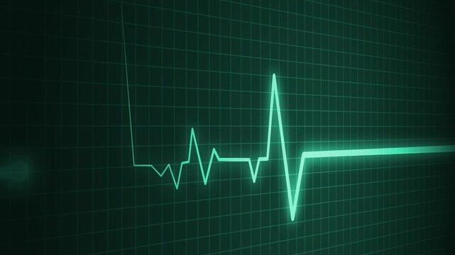Heart beat line on graph paper showing an ecg pattern and medical signal animation