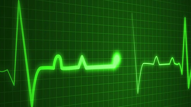 Health heartbeat line showing heart rhythm and medical monitor trace animation