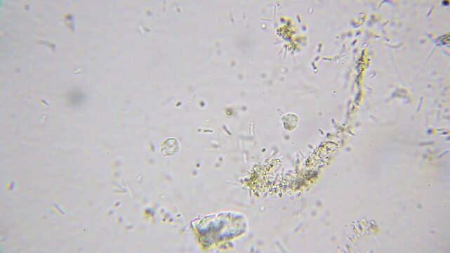 Two Heliozoa heliozoan amoebas surrounded by swimming bacteria cells, microscopic view at 1000x magnification, brightfield microscopy