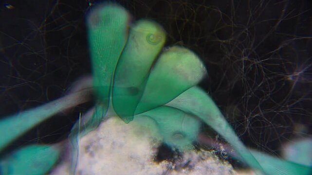 Group of trumpet-shaped Stentor coeruleus ciliates attached to a substrate, microscopic darkfield view at 100x magnification