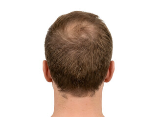Fototapeta premium Back view of a man with a hair whorl isolated on transparent background
