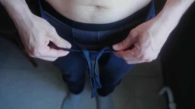 Man showing significant weight loss from chronic cholecystitis, holding oversized loose pants that no longer fit. Medical diet, gallbladder polyps condition. Weight loss from gallbladder disease