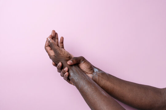 Black man holding sore wrist, hand pain on pink background