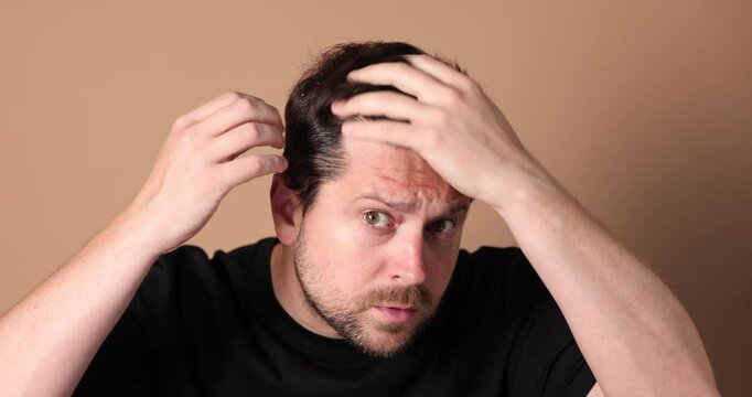 Dandruff problem. Worried man examining his head on beige background, camera moving forward
