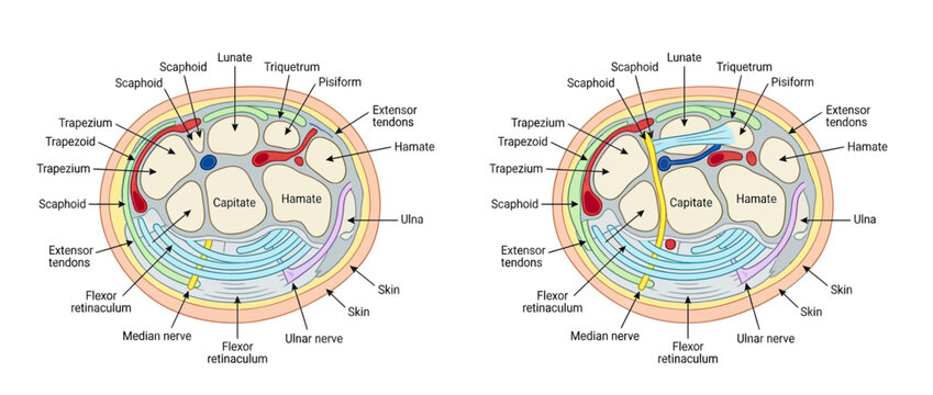 Anatomical Cross-Section of the Human Wrist with Labels