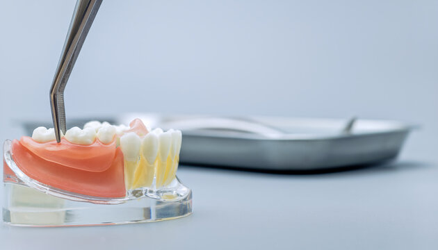 Metal Dental Tweezers Manipulating Removable Gum on Anatomical Jaw Model with Medical Tray Background