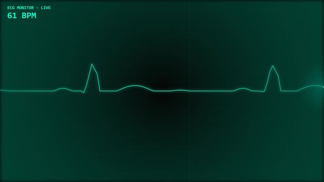 Digital ECG Heart Monitor Screen Showing Normal Sinus Rhythm