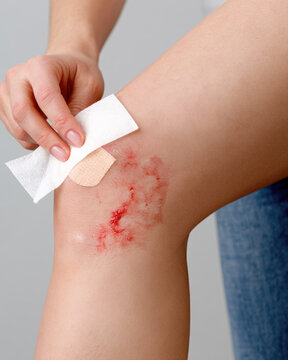 Knee scrape wound close up view gentle first aid care on grazed knee with sterile gauze wipe and adhesive bandage, clean light background, calm studio scene
